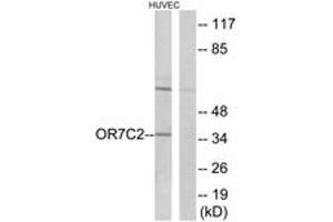 Western blot analysis of extracts from HuvEc cells, using OR7C2 Antibody. (OR7C2 抗体  (AA 198-247))