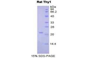 SDS-PAGE (SDS) image for CD90 (THY1) (AA 1-161) protein (His tag) (ABIN1821661) (CD90 Protein (THY1) (AA 1-161) (His tag))