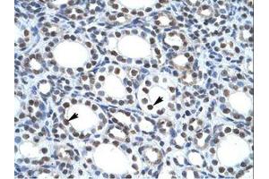 Image no. 1 for anti-tyrosyl-DNA phosphodiesterase 2 (TDP2) (AA 154-203) antibody (ABIN6735942) (TDP2 抗体  (AA 154-203))