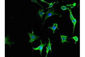 Immunofluorescent analysis of MCF-7 cells using ABIN7166739 at dilution of 1:100 and Alexa Fluor 488-congugated AffiniPure Goat Anti-Rabbit IgG(H+L) (NPY6R 抗体  (AA 1-39))