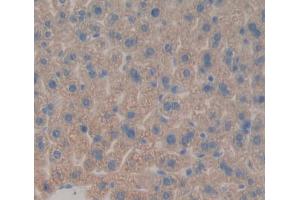 Used in DAB staining on fromalin fixed paraffin- embedded liver tissue (AGXT 抗体  (AA 120-334))
