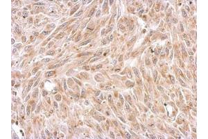 Immunohistochemistry (IHC) image for anti-Secretogranin II (SCG2) antibody (ABIN2856983)