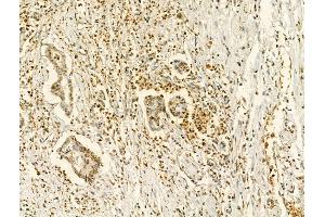 ABIN6256069 and ABIN6267241 at 1/100 staining Human normal tissues adjacent to liver cancer by IHC-P. (JAK2 抗体  (pTyr931))
