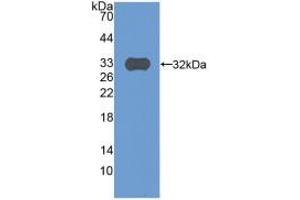 Western blot analysis of recombinant Human C9. (C9 抗体  (AA 22-265))