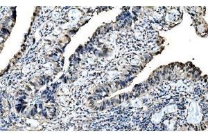 IHC analysis of DLX2 using anti-DLX2 antibody (ABIN7599936). (DLX2 抗体  (AA 13-310))