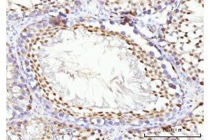 IHC analysis of KIFC1 using anti-KIFC1 antibody (ABIN7599523).