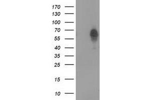 Western Blotting (WB) image for anti-Bestrophin 3 (BEST3) antibody (ABIN1501731) (Bestrophin 3 抗体)