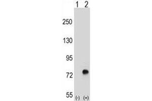 Western blot analysis of TGFBI antibody and 293 cell lysate either nontransfected (Lane 1) or transiently transfected (2) with the TGFBI gene. (TGFBI 抗体  (AA 106-135))