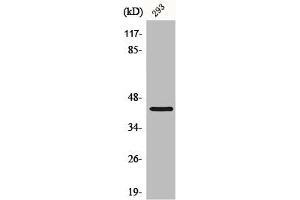 Western Blot analysis of HepG2 cells using CBX6 Polyclonal Antibody (CBX6 抗体  (N-Term))