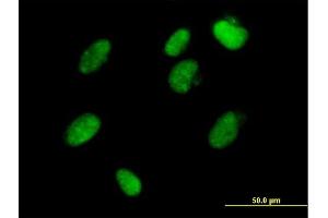 Immunofluorescence of  purified  MaxPab antibody to ZFP1 on HeLa cell. (Zfp-1 抗体  (AA 1-352))