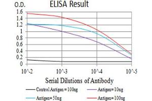 Black line: Control Antigen (100 ng),Purple line: Antigen (10 ng), Blue line: Antigen (50 ng), Red line:Antigen (100 ng) (BCL9L 抗体  (AA 606-751))