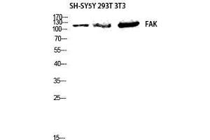 Western Blot (WB) analysis of SH-SYSY 293 3T3 lysis using FAK antibody. (FAK 抗体  (Thr444))
