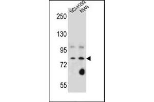 Western blot analysis of SCEL Antibody (Center) Cat. (SCEL 抗体  (Middle Region))