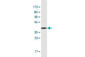 Western Blot detection against Immunogen (36. (TLN1 抗体  (AA 1324-1424))