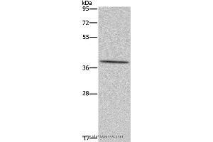 Western blot analysis of Hela cell, using MT-ND1 Polyclonal Antibody at dilution of 1:450