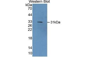 Detection of Recombinant COL9a1, Rat using Polyclonal Antibody to Collagen Type IX Alpha 1 (COL9a1) (COL9A1 抗体  (AA 24-268))