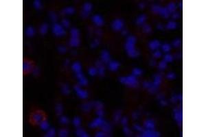 Immunofluorescence analysis of Rat lung tissue using TGFB1 Polyclonal Antibody at dilution of 1:200. (TGFB1 抗体)