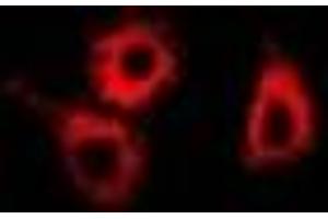 Immunofluorescent analysis of SMYD4 staining in MCF7 cells. (SMYD4 抗体)