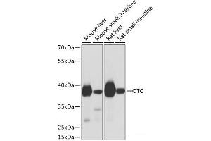 Western blot analysis of extracts of various cell lines using OTC Polyclonal Antibody at dilution of 1:1000. (OTC 抗体)