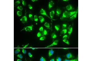 Immunofluorescence analysis of MCF-7 cells using SLC22A5 Polyclonal Antibody (SLC22A5 抗体)