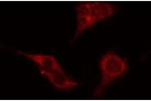 ABIN6276528 staining Hela cells by IF/ICC. (ATG4C 抗体  (N-Term))