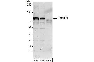 anti-Pyridoxal-Dependent Decarboxylase Domain Containing 1 (PDXDC1) (AA 550-600) antibody