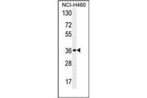 Western blot analysis of OR4A47 Antibody (C-term) in NCI-H460 cell line lysates (35ug/lane). (OR4A47 抗体  (C-Term))
