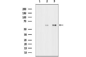 anti-Melanoma Antigen Family E, 2 (MAGEE2) (Internal Region) antibody