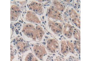 Used in DAB staining on fromalin fixed paraffin- embedded stomach tissue (ABCF1 抗体  (AA 625-845))