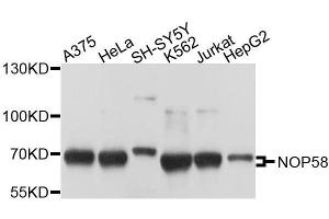 Western blot analysis of extracts of various cell lines, using NOP58 antibody. (NOP58 抗体  (AA 360-529))