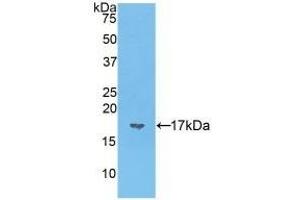 Western Blotting (WB) image for anti-Vasoactive Intestinal Peptide (Vip) (AA 28-159) antibody (ABIN7431698)
