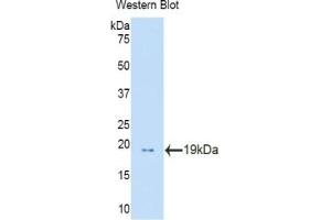 Detection of Recombinant PFN1, Human using Polyclonal Antibody to Profilin 1 (PFN1) (PFN1 抗体  (AA 1-139))