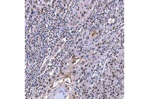 IHC analysis of SAE1 using anti-SAE1 antibody (ABIN7601346).