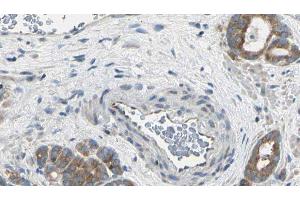 ABIN6275049 at 1/100 staining Human prostate tissue by IHC-P. (AGBL2 抗体  (C-Term))