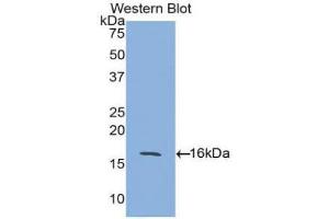 Western blot analysis of the recombinant protein. (ACVR2A 抗体  (AA 20-135))