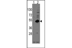 Image no. 1 for anti-Nuclear Receptor Subfamily 0, Group B, Member 1 (NR0B1) (C-Term) antibody (ABIN357834) (NR0B1 抗体  (C-Term))