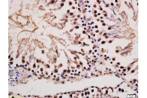 Formalin-fixed and paraffin embedded rat testis labeled with Rabbit Anti-MAP2(Ser136) Polyclonal Antibody, Unconjugated (ABIN743648) at 1:200 followed by conjugation to the secondary antibody and DAB staining (MAP2 抗体  (pSer136))