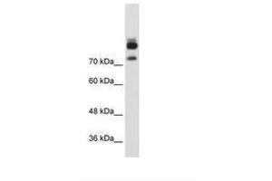 Image no. 1 for anti-Myotubularin Related Protein 1 (MTMR1) (AA 551-600) antibody (ABIN203423) (MTMR1 抗体  (AA 551-600))