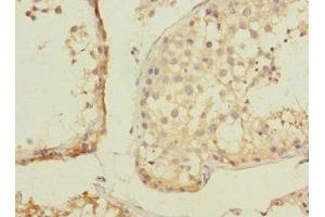 Immunohistochemistry of paraffin-embedded human testis tissue using ABIN7176401 at dilution of 1:100 (ZNF582 抗体  (AA 1-300))