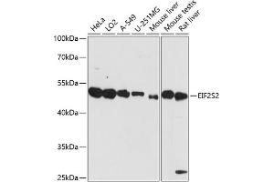 Western blot analysis of extracts of various cell lines, using EIF2S2 antibody (ABIN7267033) at 1:3000 dilution. (EIF2S2 抗体  (AA 1-175))