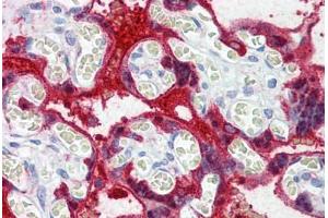 Human Placenta: Formalin-Fixed, Paraffin-Embedded (FFPE) (Transglutaminase 2 抗体  (AA 431-480))