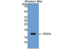 Western Blotting (WB) image for anti-CD160 (CD160) (AA 37-154) antibody (ABIN1858289) (CD160 抗体  (AA 37-154))