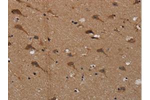 The image on the left is immunohistochemistry of paraffin-embedded Human brain tissue using ABIN7191822(PDE5A Antibody) at dilution 1/50, on the right is treated with synthetic peptide. (PDE5A 抗体)