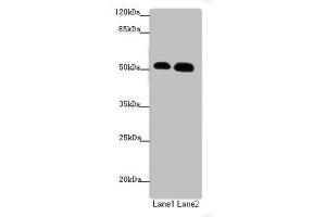 Western blot All lanes: ATMIN antibody at 1. (ATM Interactor 抗体  (AA 160-360))