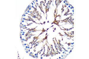 Immunohistochemistry (IHC) image for anti-Kinesin Family Member 17 (KIF17) (AA 360-660) antibody (ABIN7268123)