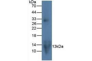 Detection of MIP3a in Rat Lymphocyte Cells using Monoclonal Antibody to Macrophage Inflammatory Protein 3 Alpha (MIP3a) (CCL20 抗体  (AA 24-95))