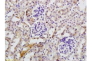 Immunohistochemistry (Paraffin-embedded Sections) (IHC (p)) image for anti-Interleukin 17 Receptor B (IL17RB) (AA 351-450) antibody (ABIN747968)