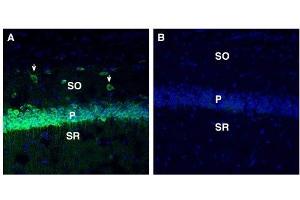 Expression of SORL1 in mouse hippocampus. (SORL1 抗体  (Extracellular, N-Term))