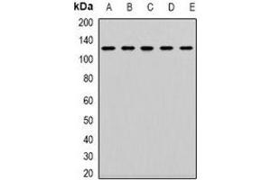 Western blot analysis of CD133 expression in K562 (A), SW620 (B), Jurkat (C), mouse kidney (D), mouse lung (E) whole cell lysates. (CD133 抗体  (N-Term))