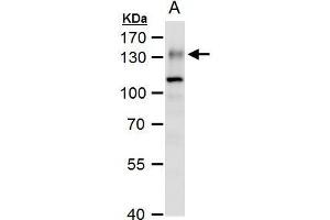 WB Image ENPP1 antibody [N2C2], Internal detects ENPP1 protein by western blot analysis. (ENPP1 抗体)